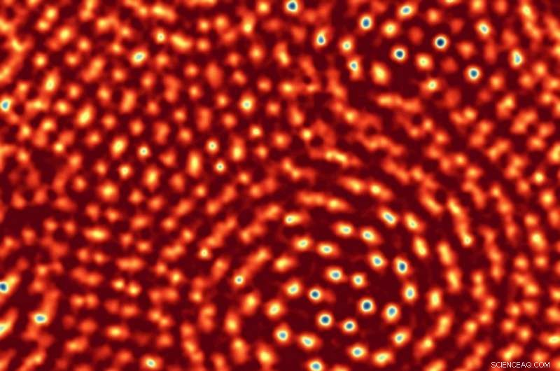 New Detector Breaks Records, Delivering Unprecedented Resolution in Electron Microscopy
