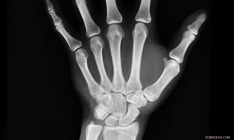 Revolutionary Flexible X‑ray Detector Promises Greater Accuracy in Mammography and Radiotherapy