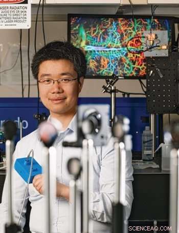 Advanced Imaging Techniques for Detecting Small Vessel Vasculitis