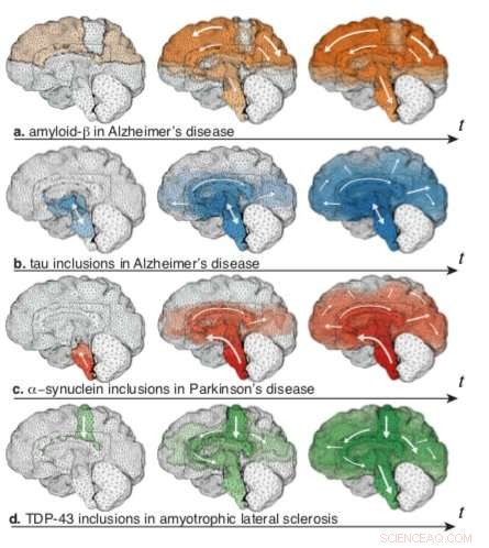 Scientists Map the Pathways of Toxic Proteins in the Brain, Shedding Light on Neurodegenerative Diseases