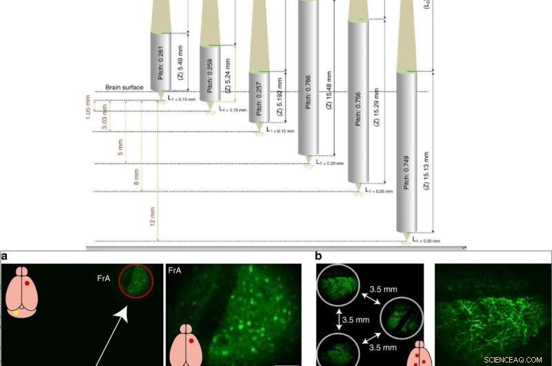 MATRIEX Imaging: Real-Time, Multi-Region Neural Activity Tracking Across the Brain