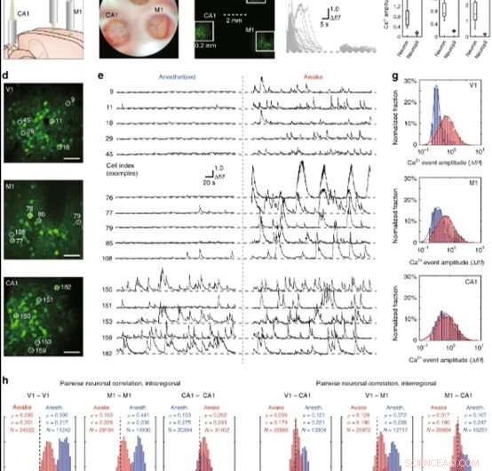 MATRIEX Imaging: Real-Time, Multi-Region Neural Activity Tracking Across the Brain