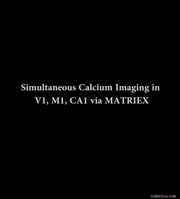 MATRIEX Imaging: Real-Time, Multi-Region Neural Activity Tracking Across the Brain