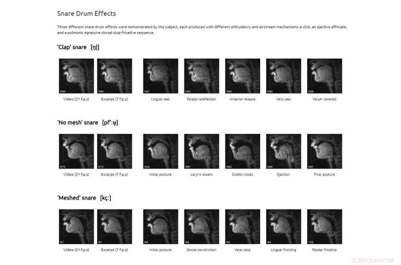Unveiling Beatboxing: Real-Time MRI Reveals How the Vocal Tract Creates Percussive Sounds