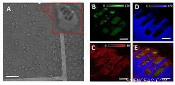 Researchers Create 3-D Chemical Maps of Individual Bacteria Using Synchrotron Imaging
