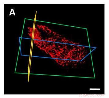 Researchers Create 3-D Chemical Maps of Individual Bacteria Using Synchrotron Imaging