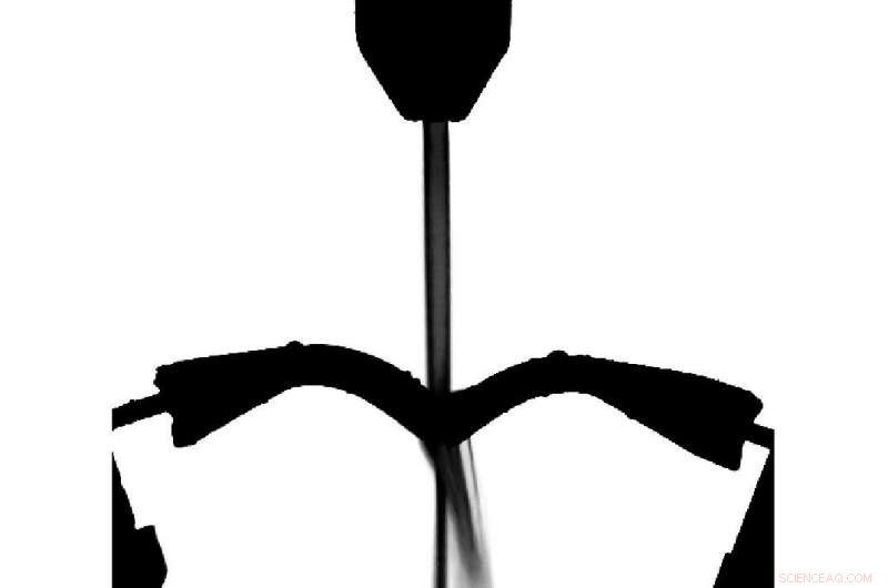 Scientists Offer Innovative Fixes to Prevent Urine Sample Splashing