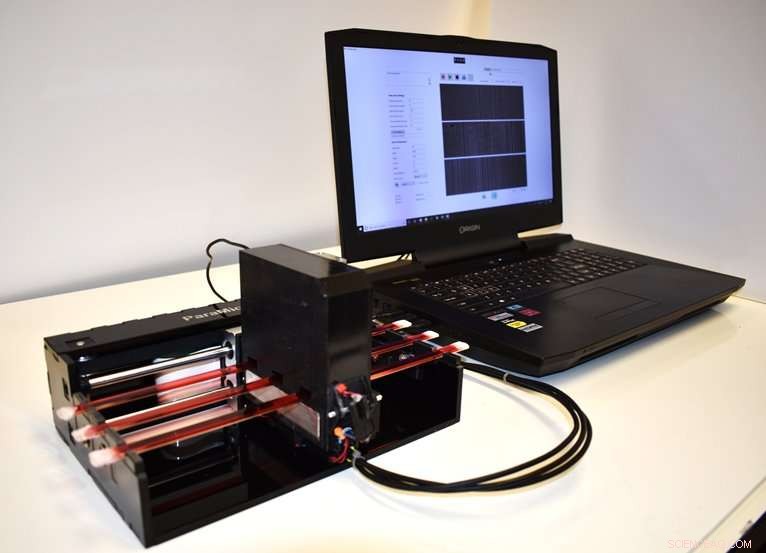 AI‑Enabled Mobile Device Accelerates Sensitive Parasite Detection