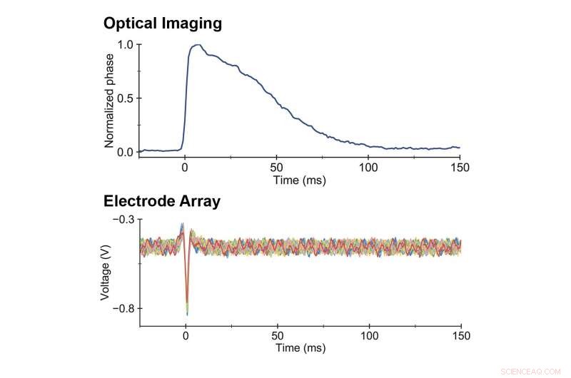 Researchers Develop Innovative Imaging Tool to Visualize Neuron Activity