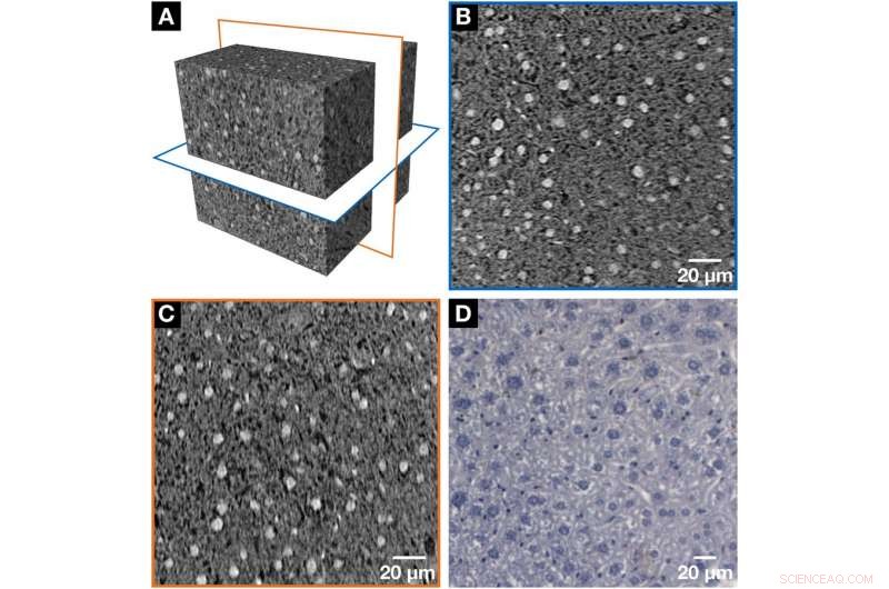 Nucleus‑Specific X‑Ray Stain Enables Precise 3‑D Virtual Histology