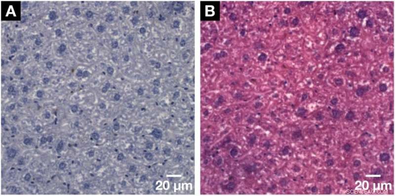 Nucleus‑Specific X‑Ray Stain Enables Precise 3‑D Virtual Histology