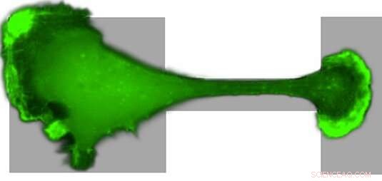 Breast Cancer Cells Navigate Tight Constrictions, Unveiling Metastatic Migration Pathways