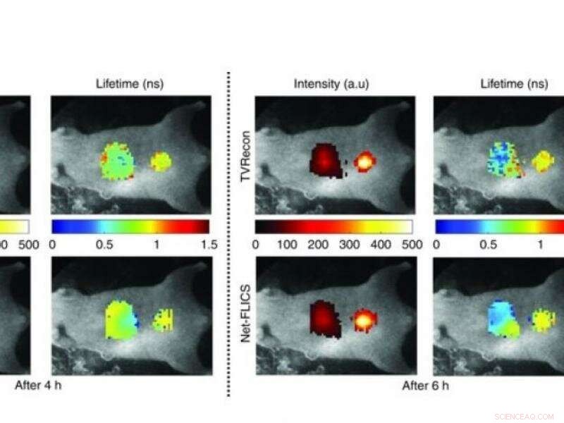 Enhancing Molecular Imaging with Advanced Deep Learning Reconstruction