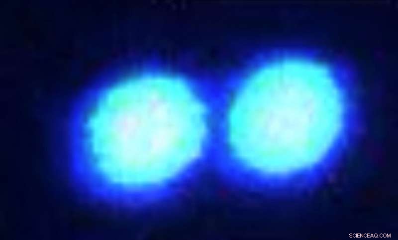 Laser Tweezers Reveal & Analyze Tiny Protein Droplets in ALS Research