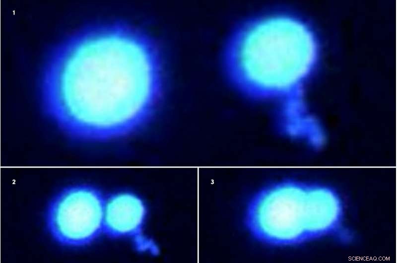 Laser Tweezers Reveal & Analyze Tiny Protein Droplets in ALS Research