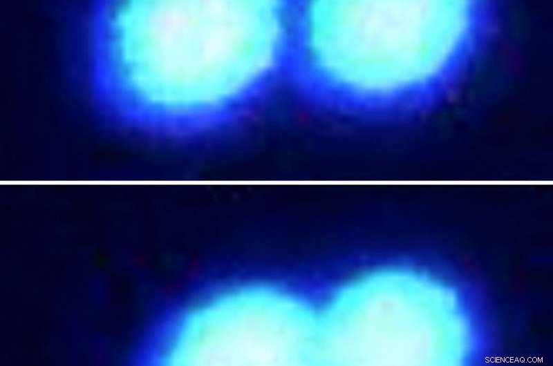 Laser Tweezers Reveal & Analyze Tiny Protein Droplets in ALS Research