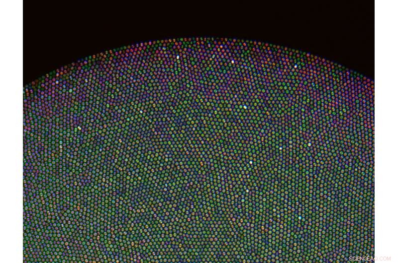 3‑D Optical Biopsies Now Possible with Light‑Field Technology Advances