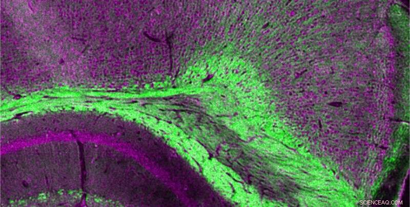 Laser Biopsy: Cutting-Edge Technique Replaces Scalpels for Precise Tissue Sampling