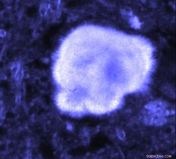 Amyloid Fibrils Emit Detectable Near‑Infrared Signal Under NIR Illumination