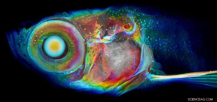 Enhanced Resolution and Scale Propel CT Scanning to New Diagnostic Heights