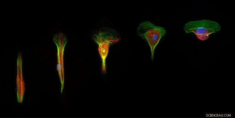 Spatial Confinement Drives Cell Velocity Variations During Collective Migration
