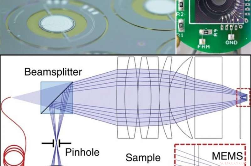 Innovative MEMS‑In‑The‑Lens Design Enhances Laser Scanning Microscopy