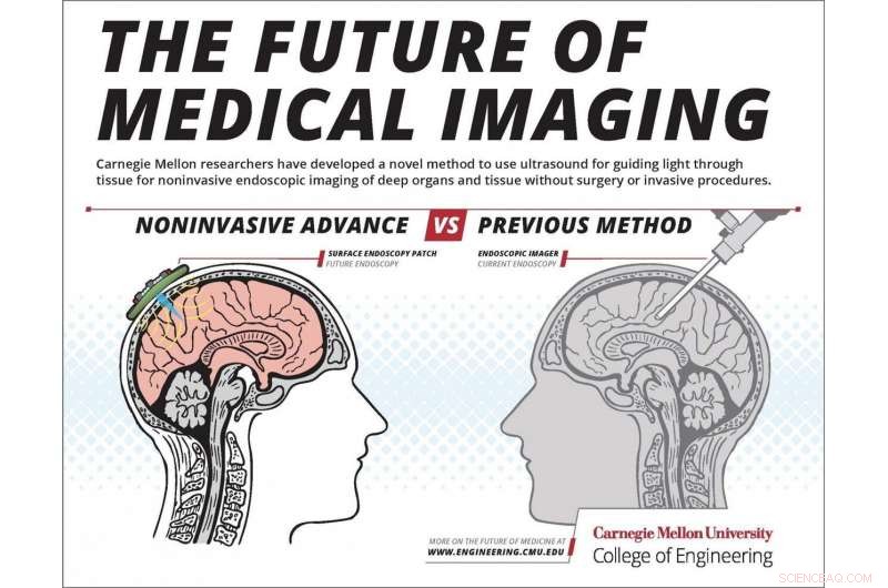 Ultrasound‑Guided Optical Imaging: A Noninvasive Alternative to Endoscopy