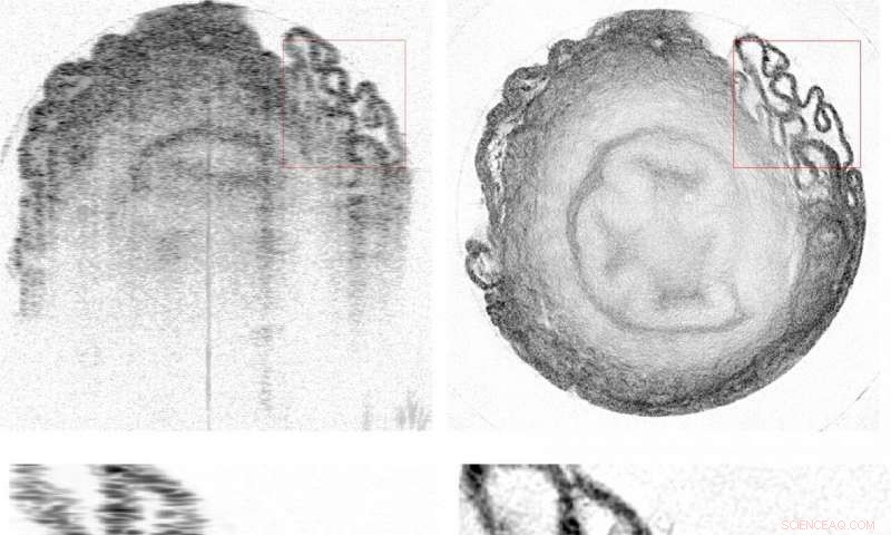AI Enhances Eye Imaging Resolution, Delivering Sharper, Noise‑Reduced Images