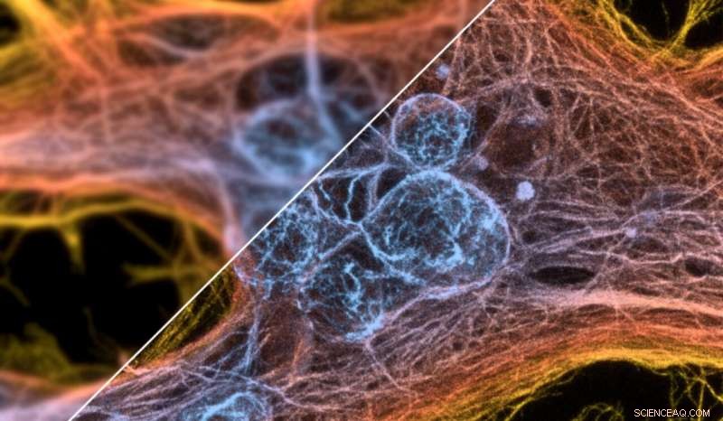 Universal Algorithm Boosts Microscopy Accuracy