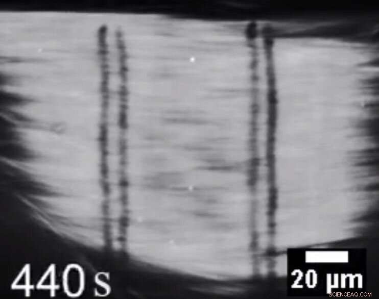 Unveiling How Cellular Spindle Machines Prevent Genetic Congestion