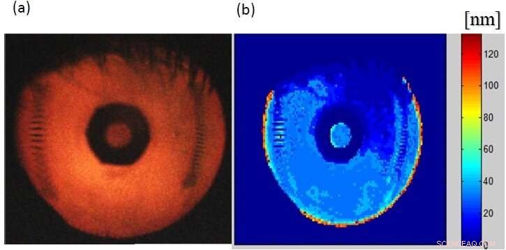 Revolutionary Optical Imager Enhances Diagnosis & Treatment of Dry Eye Disease
