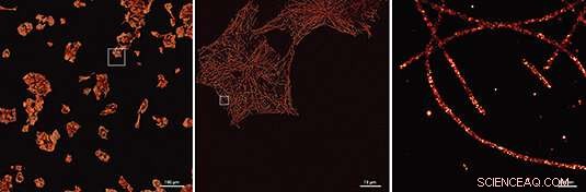 Accelerated DNA-PAINT: Ultra‑High‑Resolution Microscopy for Cellular Ultrastructure