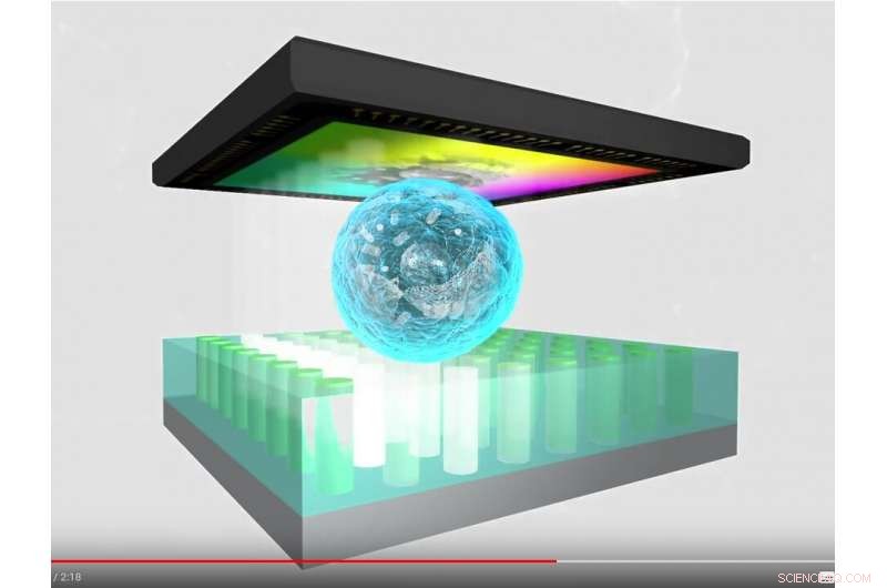 Revolutionary Lensless Microscopy: Multimodal, High-Resolution Imaging for Medical Diagnostics