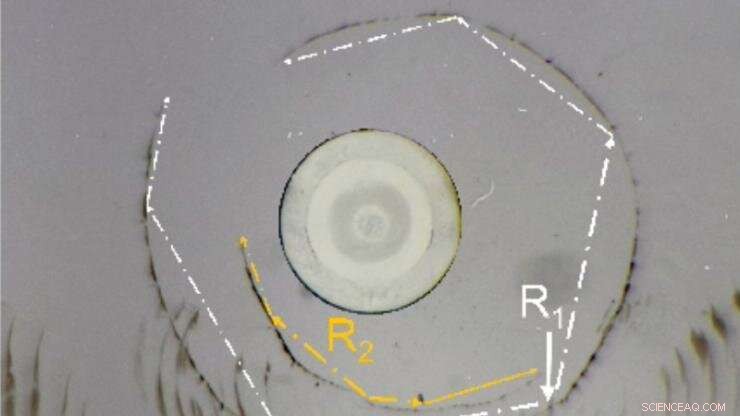 How Windshield-Cracking Raindrops Reveal a New Approach to Kidney Stone Treatment