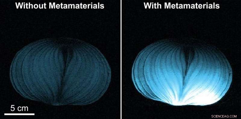 Intelligent Metamaterial Cuts MRI Costs, Boosting Accessibility