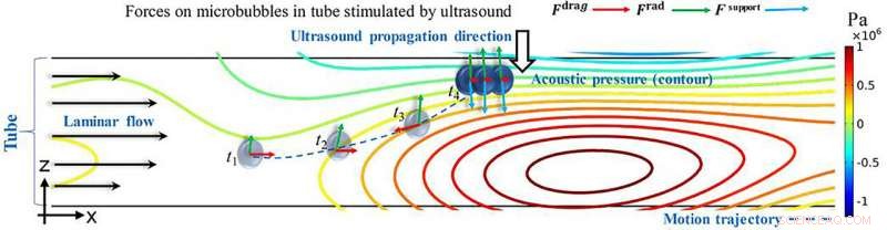 Harnessing Ultrasound to Target Drugs Directly to Tumors