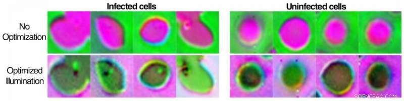 AI-Driven Microscope Adjusts Lighting in Real-Time for Superior Diagnostic Accuracy