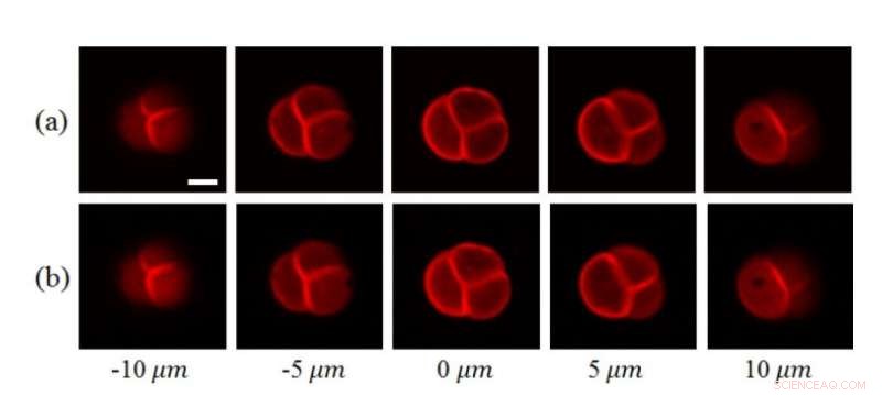 Accelerating 3‑D Biomedical Imaging with Compressive Techniques