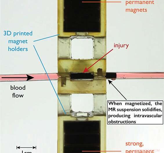 Injecting Magnetizable Fluid May Extend Survival in Trauma Patients