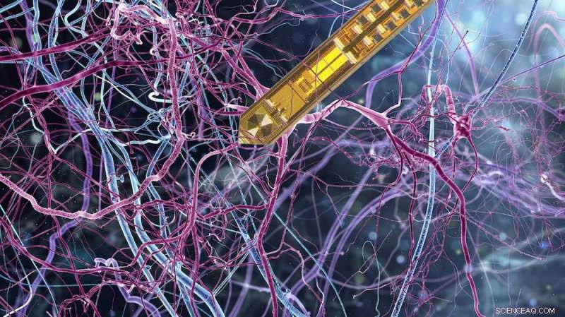 Scientists Unveil First Implantable Magnet Resonance Detector