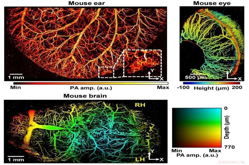 Super‑Resolution Photoacoustic Microscopy Detects Clogged Blood Vessels in Mice