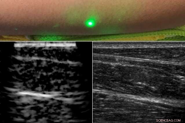 Researchers Achieve First Human Imaging Using Laser Ultrasound