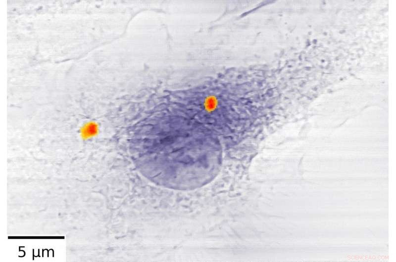Dual‑Energy X‑Ray Imaging Advances Tuberculosis and Osteoporosis Diagnostics