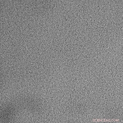 Unveiling Microscopic Motions in Soft Gels