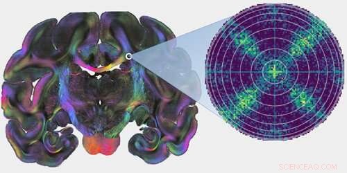 Revealing Brain Fiber Crossings: Scattered Light Imaging Breaks New Ground