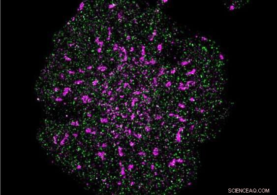 Self-Aligning Microscope Breaks New Ground in Super-Resolution Imaging
