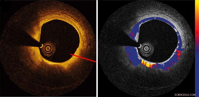 Advancing OCT: Introducing a Novel Contrast Technique for Enhanced Imaging