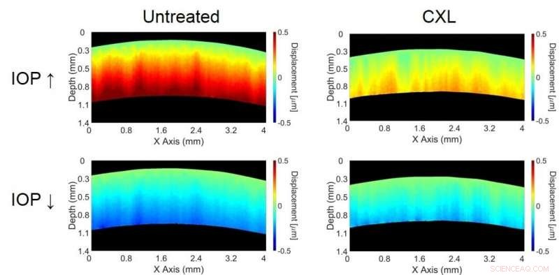 Using Optical Coherence Tomography to Monitor Eye Mechanics in Sync with Heartbeats