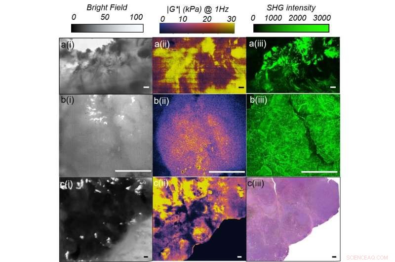 Laser Speckle Rheology: Advanced Optical Imaging of Tissue Mechanics