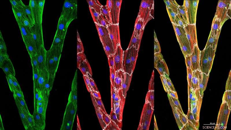 Advanced Image Analysis Sheds Light on Cardiac Cell Defects